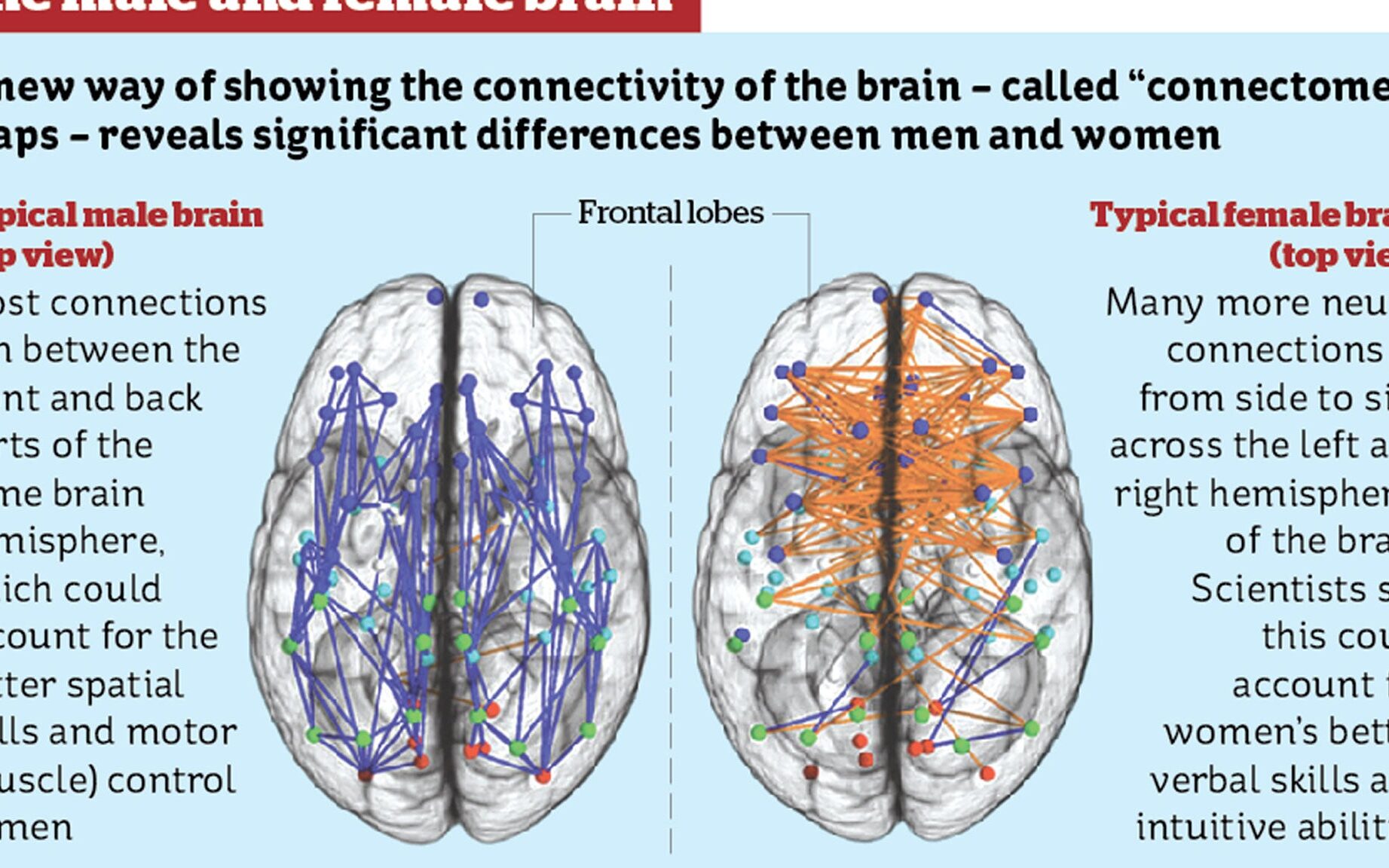 La diferencia arraigada entre los cerebros masculinos y femeninos podría...